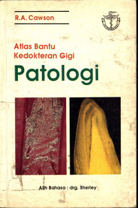 Image of Atlas  Bantu Kedokteran Gigi Patologi