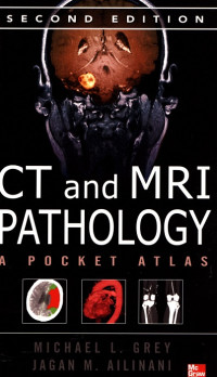 CT and MRI Pathology A Pocket Atlas