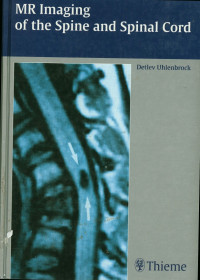 Image of MR Imaging of the Spine and Spinal Cord