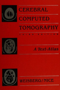 Cerebral computed tomography : a text atlas