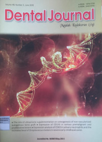 Dental Journal Majalah Kedokteran Gigi Vol. 48 No. 2 (2015):