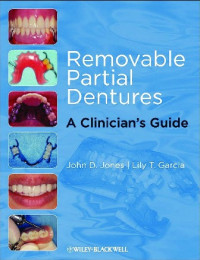 Image of Removable partial dentures : a clinician's guide